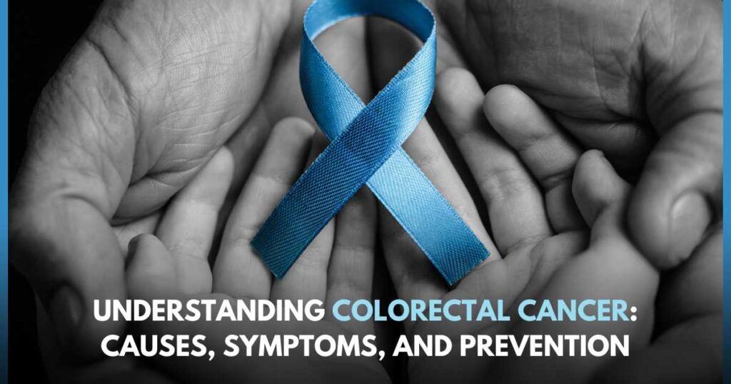 Colorectal cancer guide